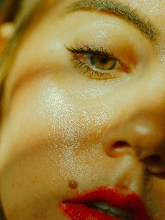 Leidest du unter starkem Schwitzen?